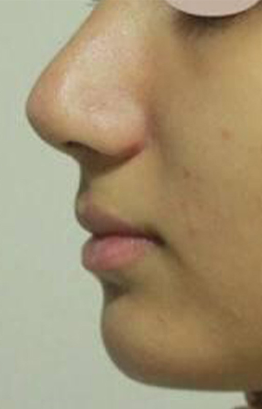 After